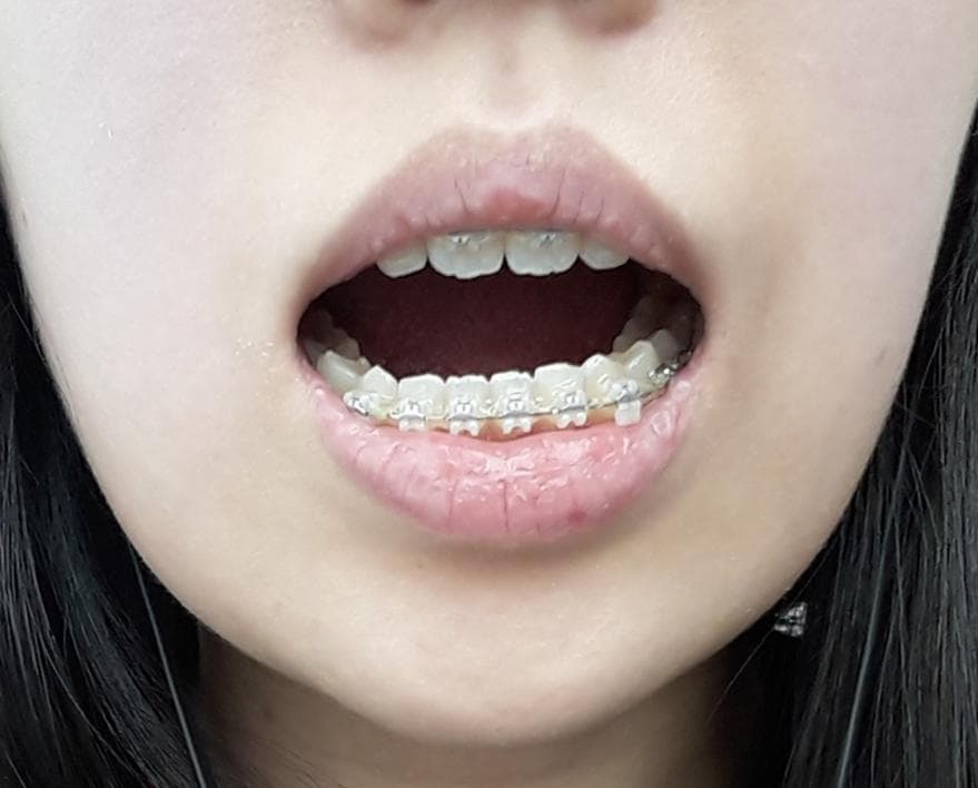 1번 째 사진