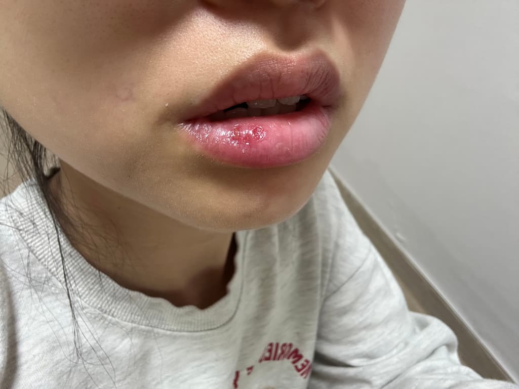 2번 째 사진