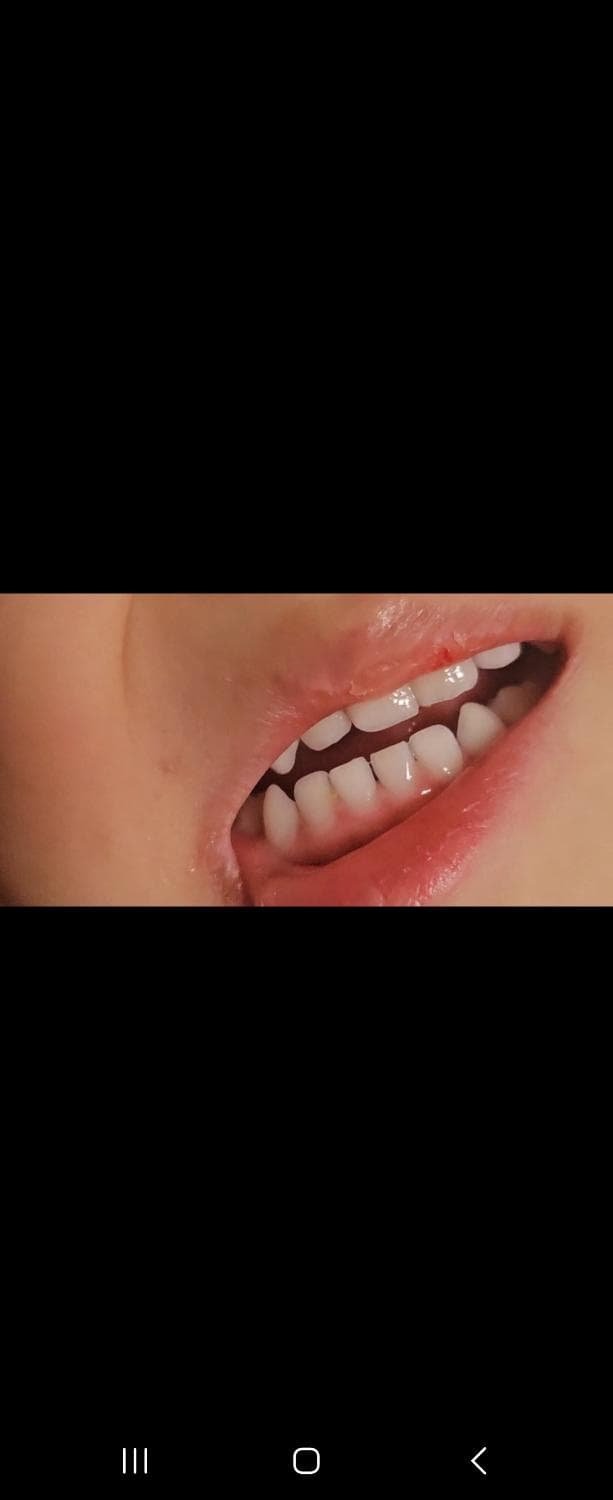 2번 째 사진