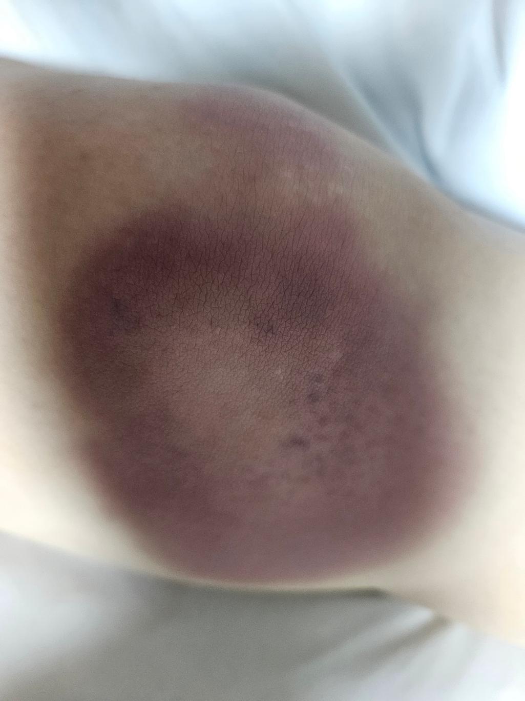 2번 째 사진
