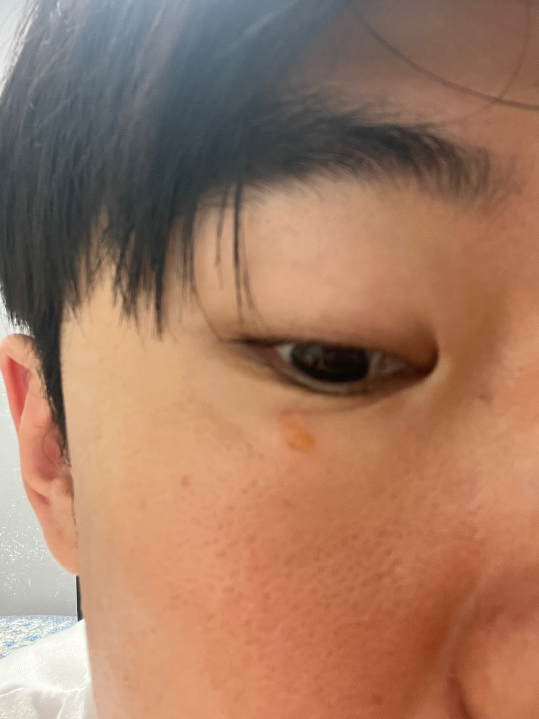 2번 째 사진