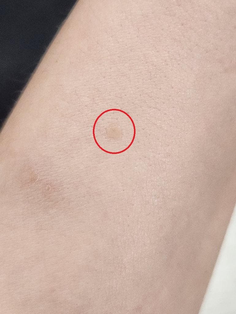 2번 째 사진