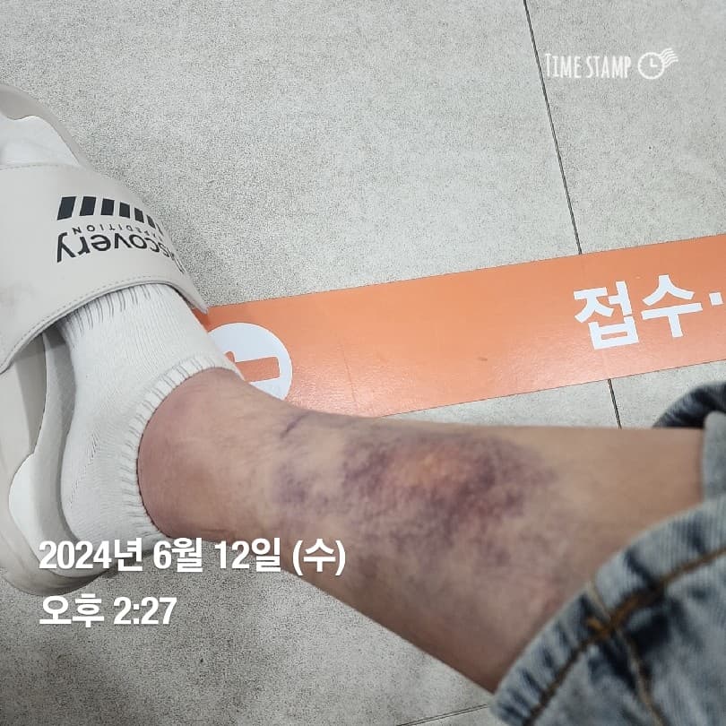 1번 째 사진