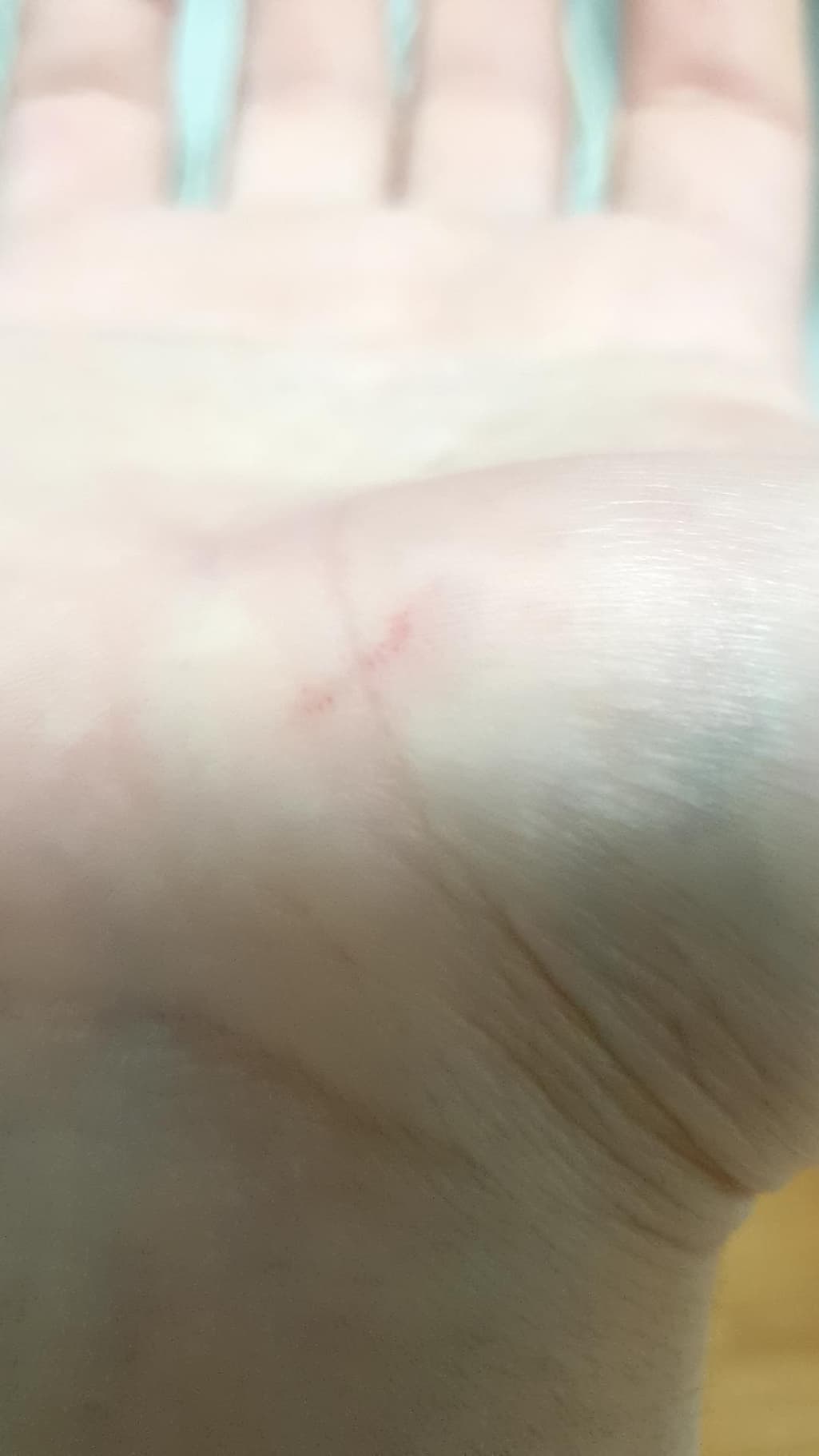2번 째 사진