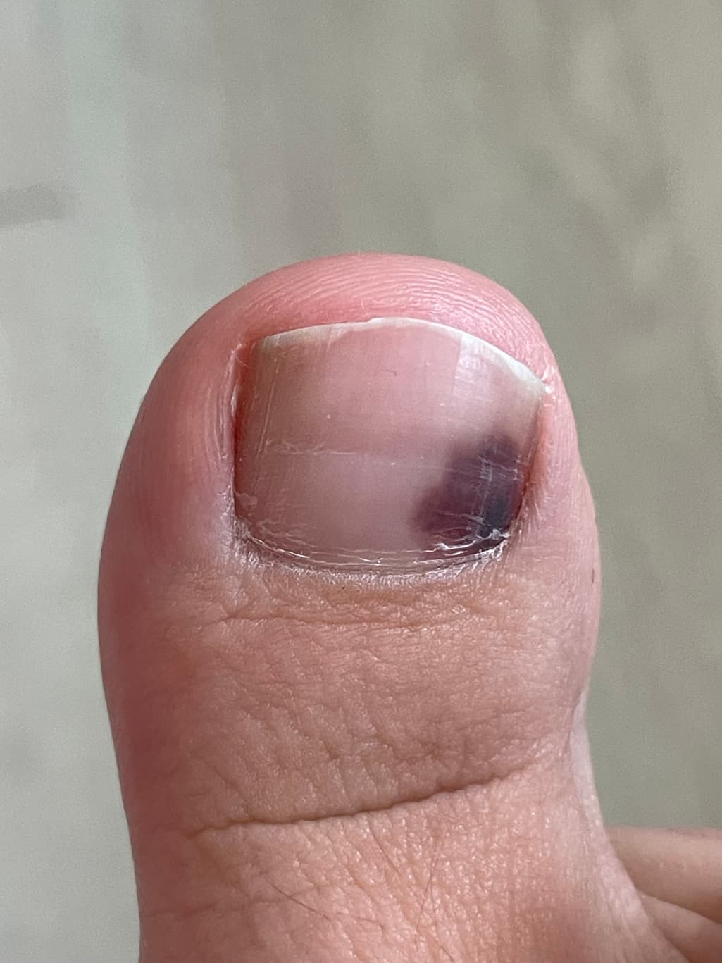 6번 째 사진