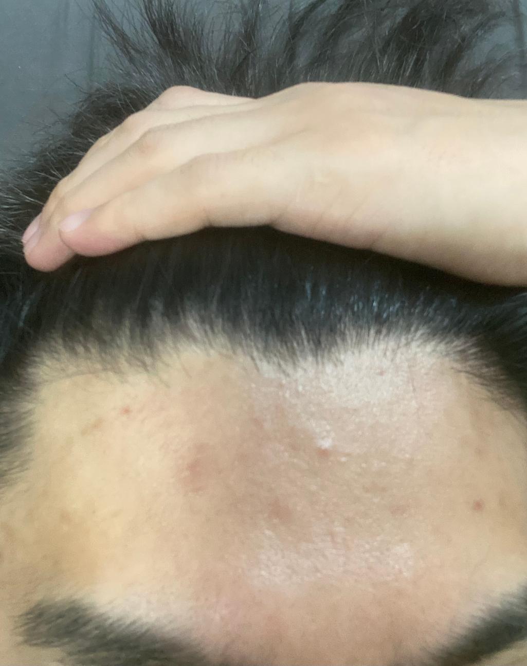 3번 째 사진