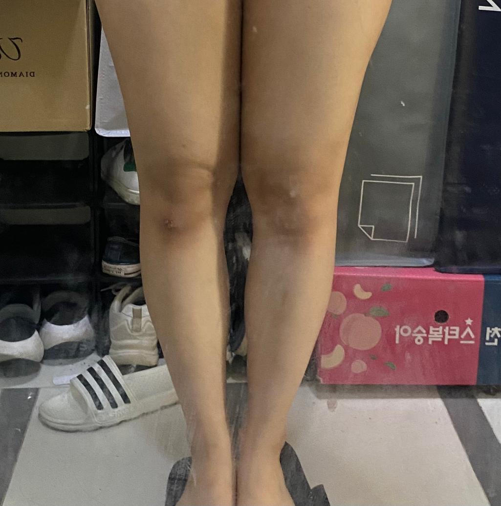 3번 째 사진
