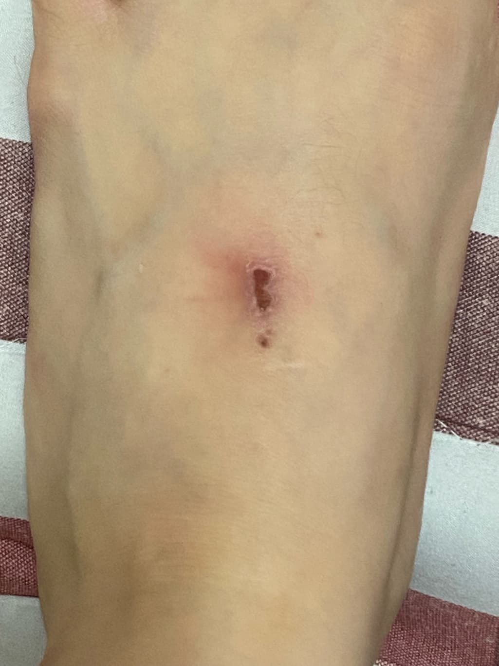 1번 째 사진
