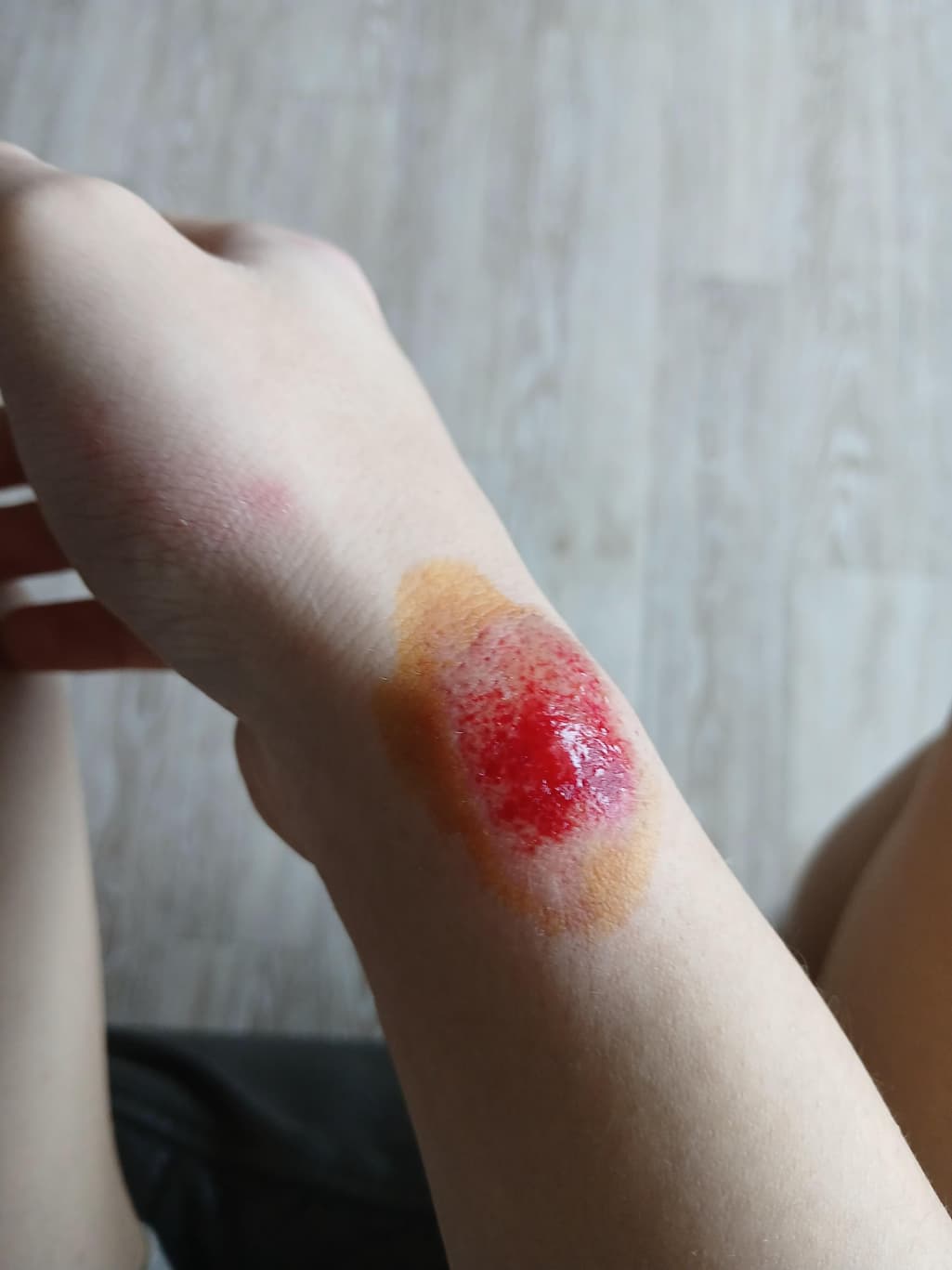 2번 째 사진