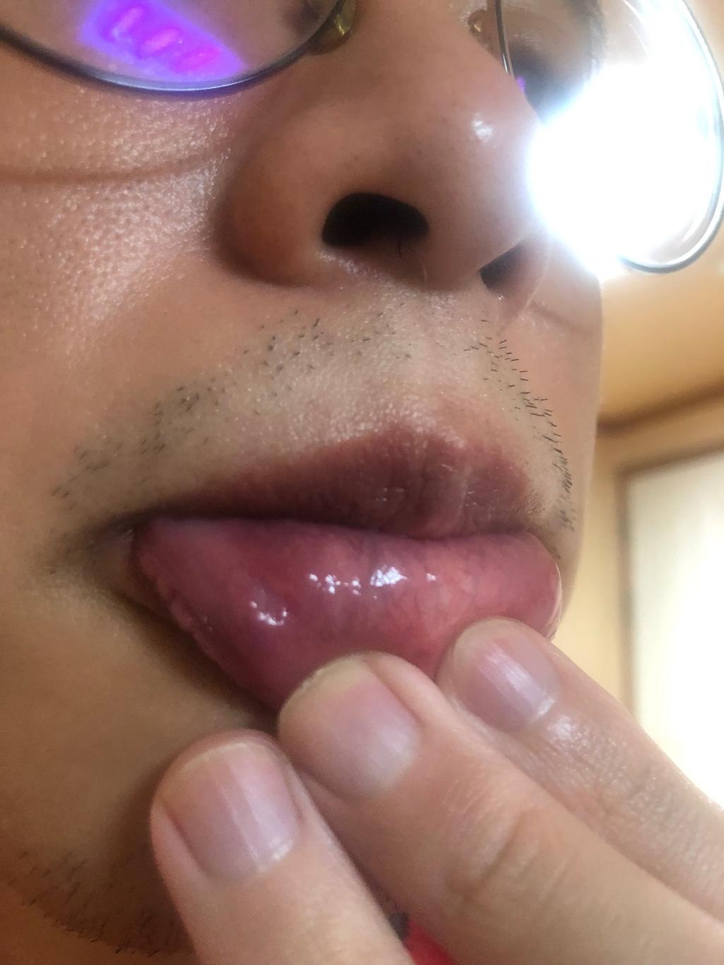 2번 째 사진