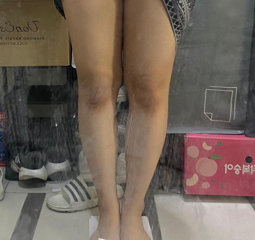 2번 째 사진