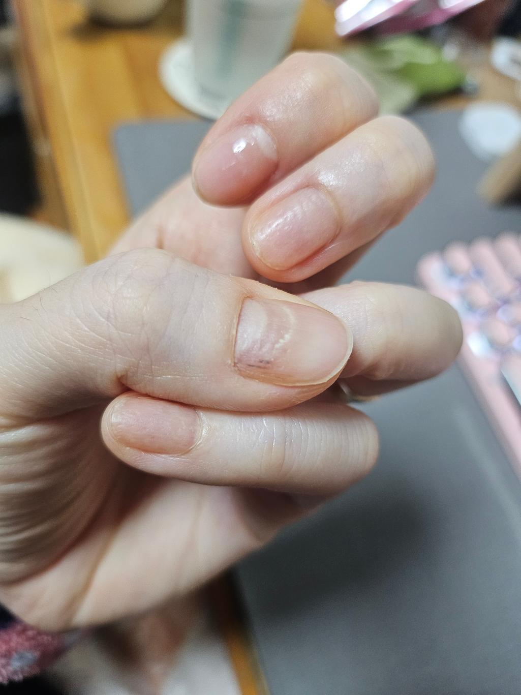 3번 째 사진