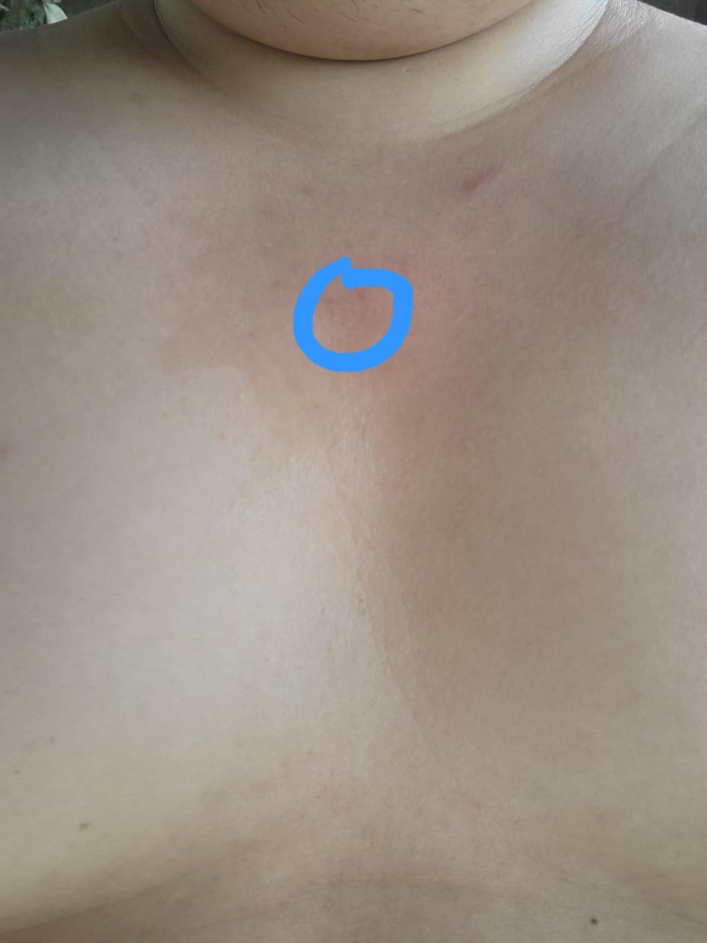 2번 째 사진