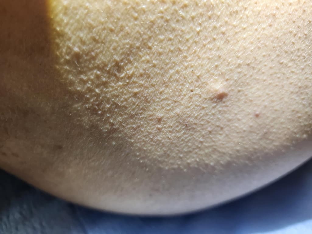 4번 째 사진