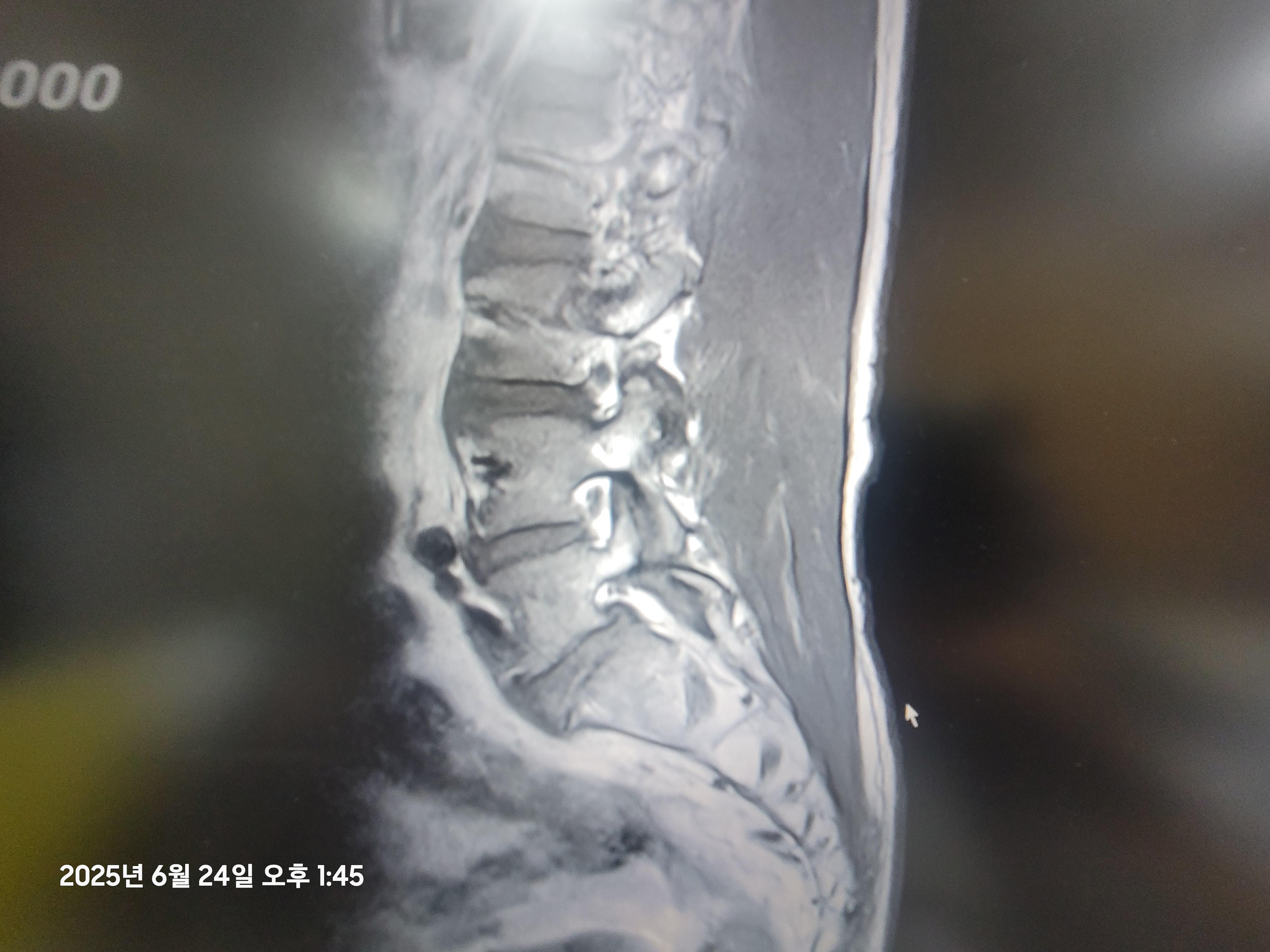 6번 째 사진
