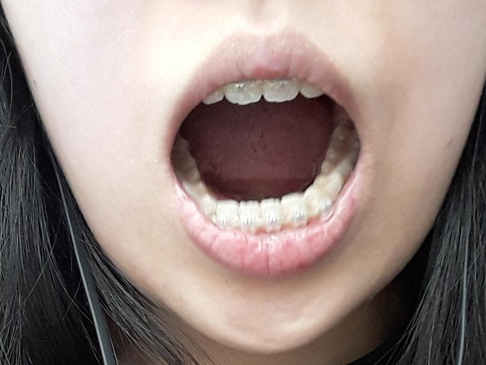 3번 째 사진