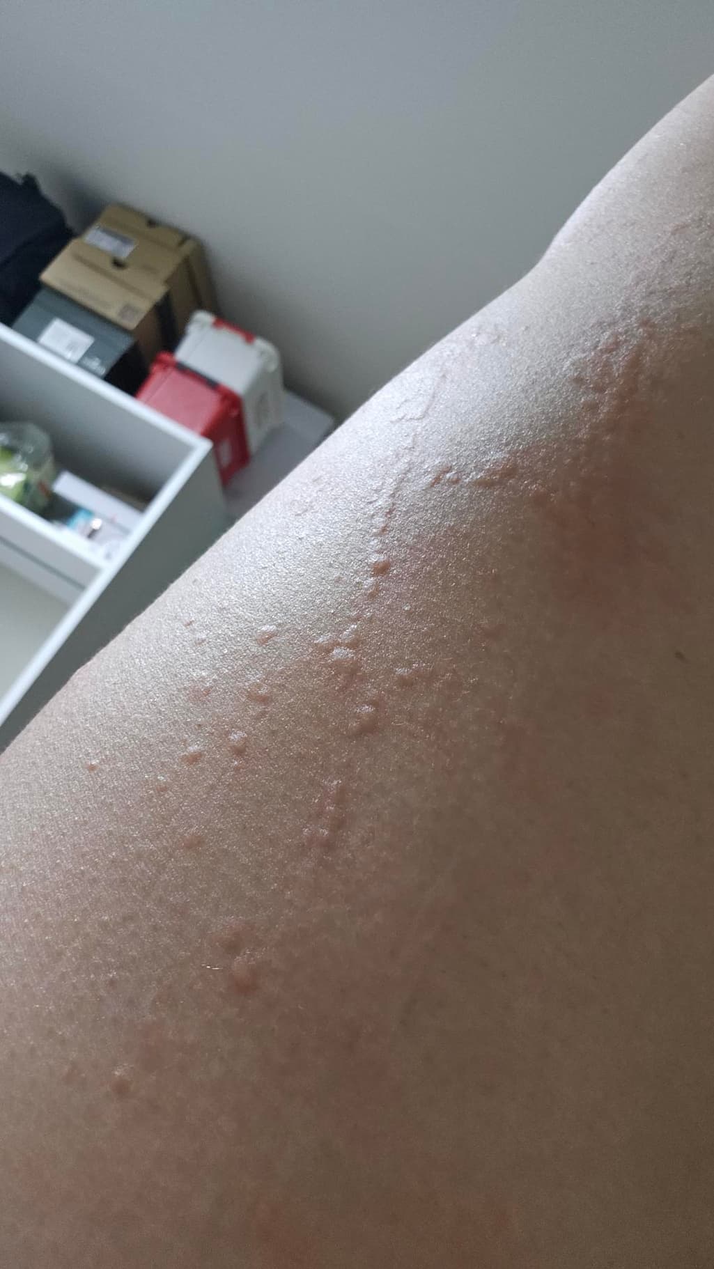 2번 째 사진