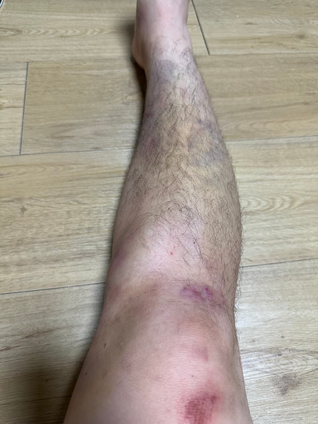 1번 째 사진