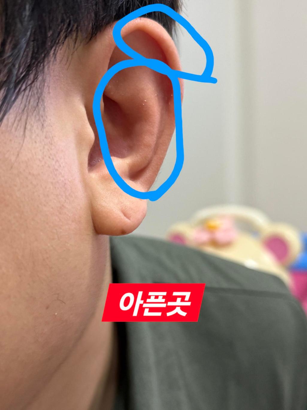 1번 째 사진
