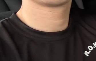 2번 째 사진