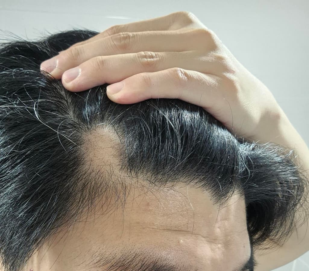 1번 째 사진
