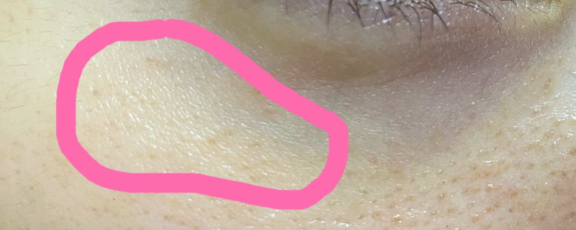 3번 째 사진
