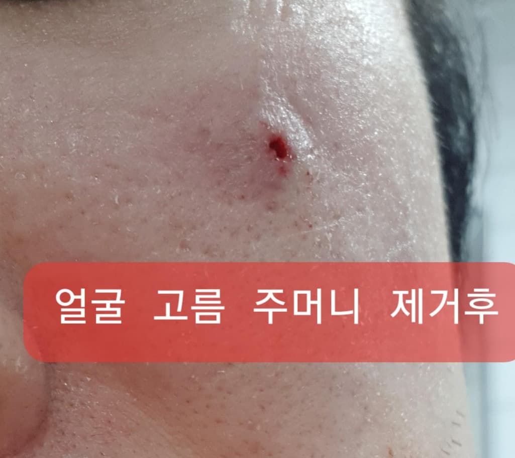4번 째 사진