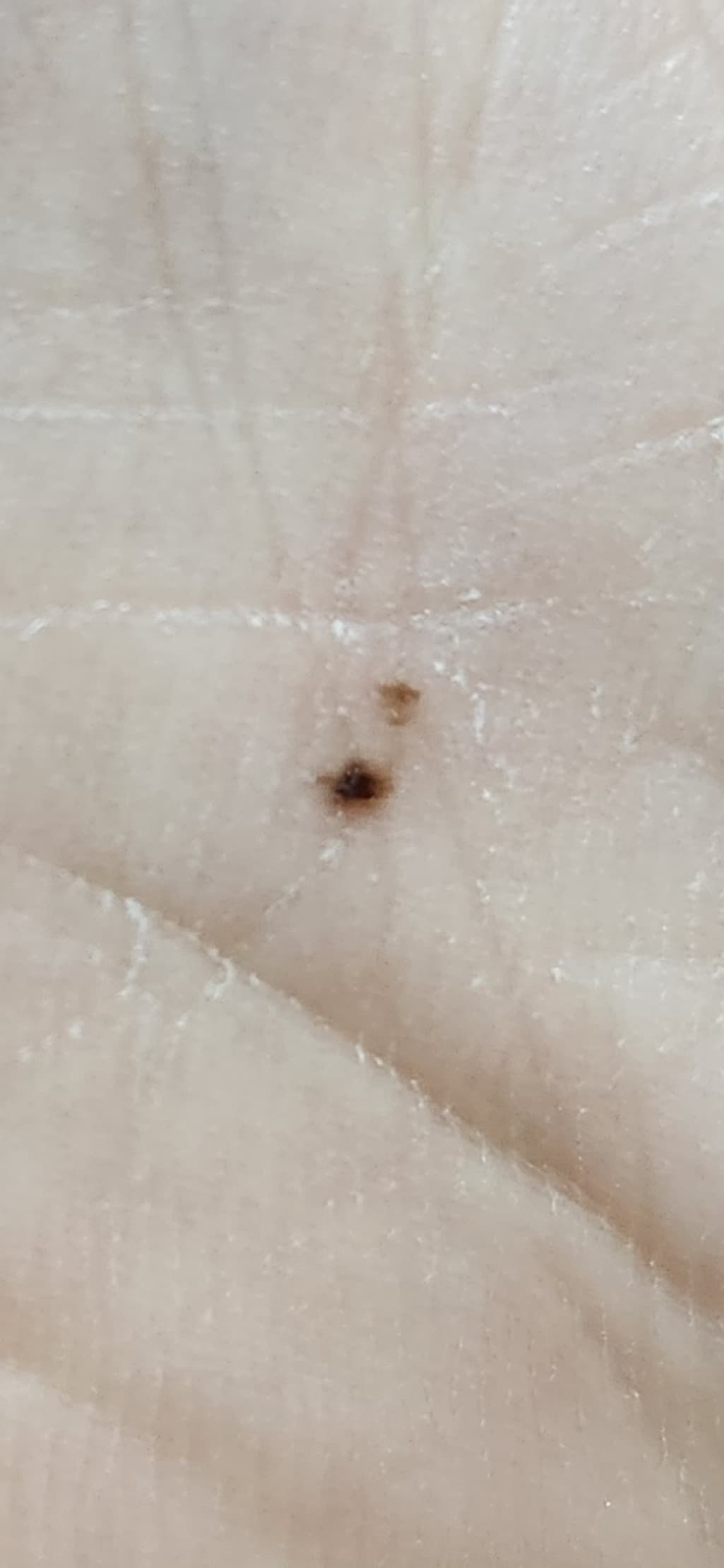 2번 째 사진