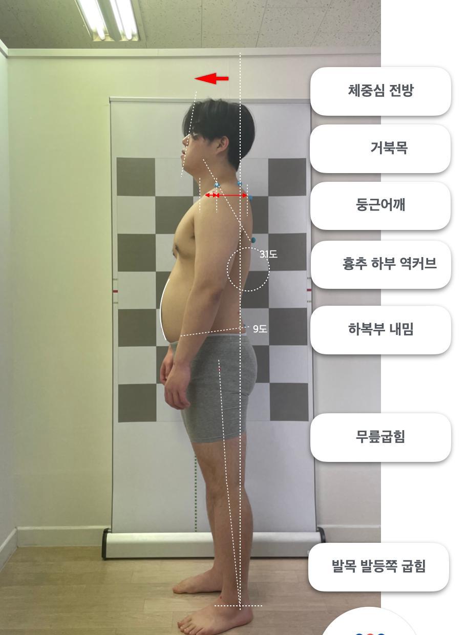 2번 째 사진