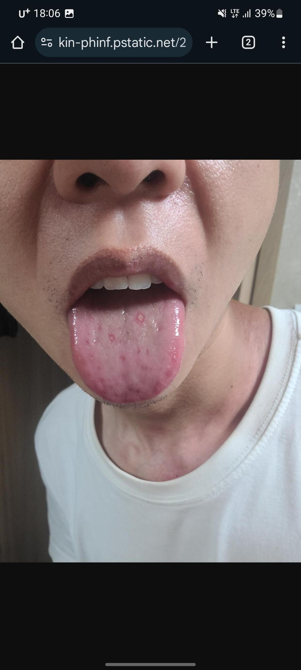 2번 째 사진