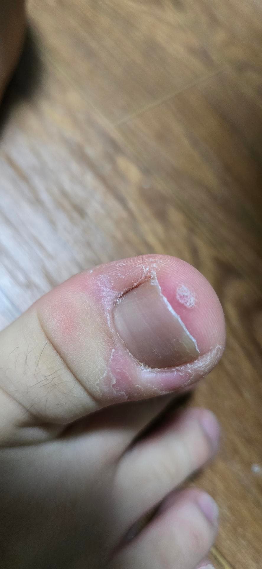 2번 째 사진