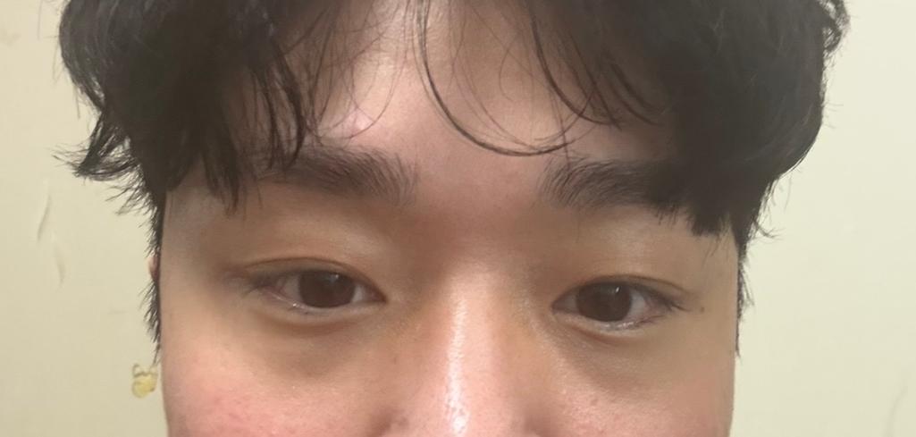 2번 째 사진