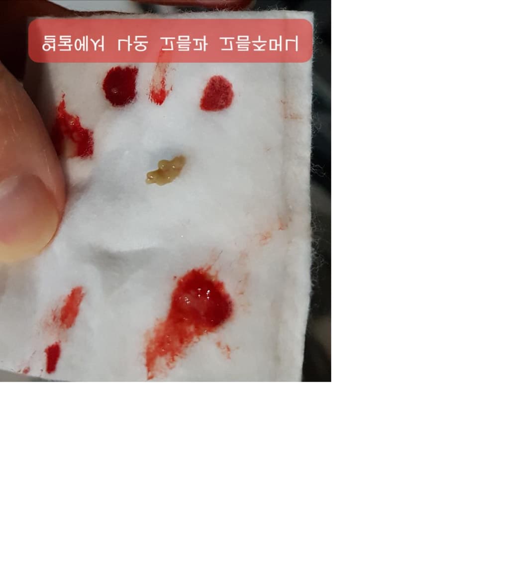 3번 째 사진
