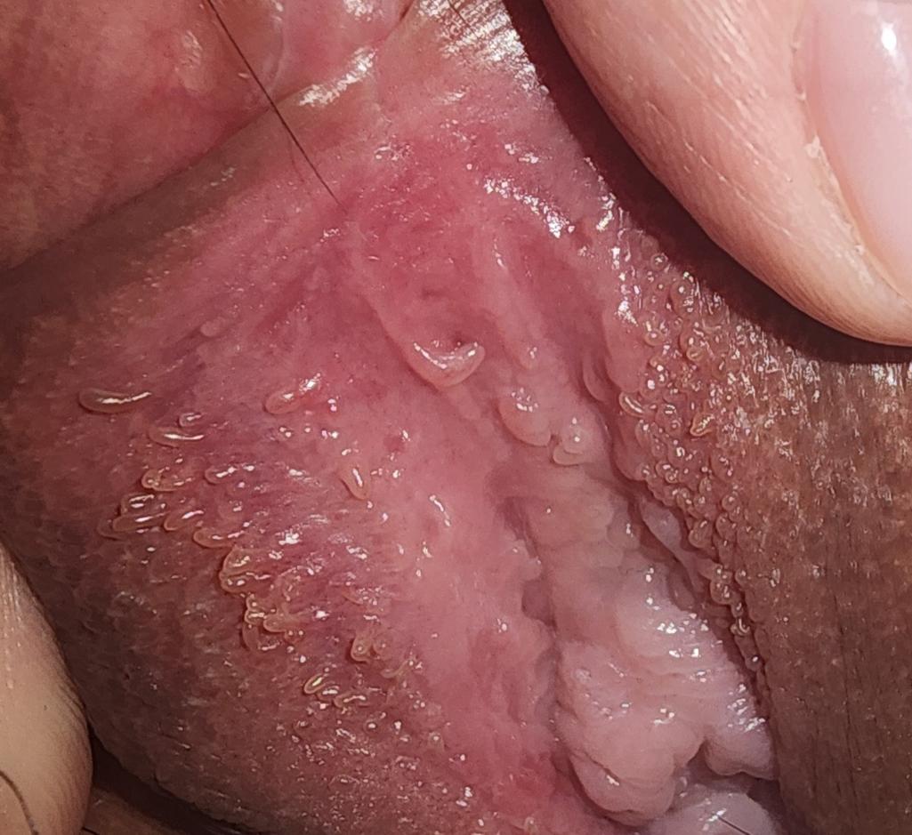 3번 째 사진