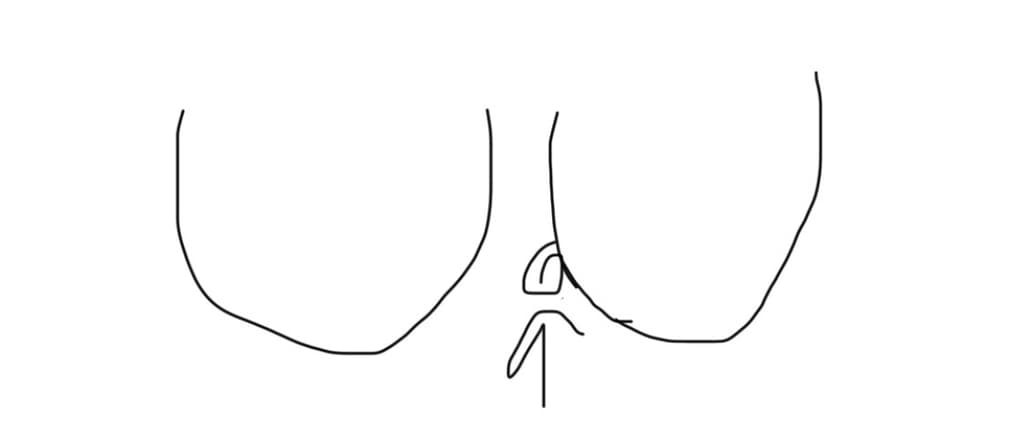 2번 째 사진