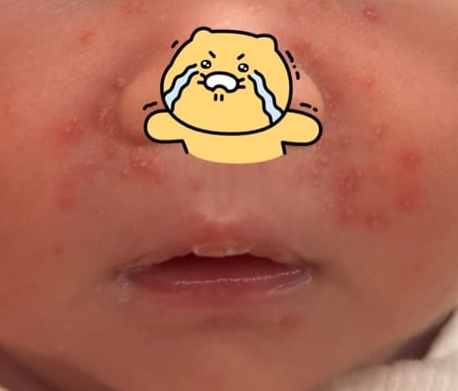 2번 째 사진