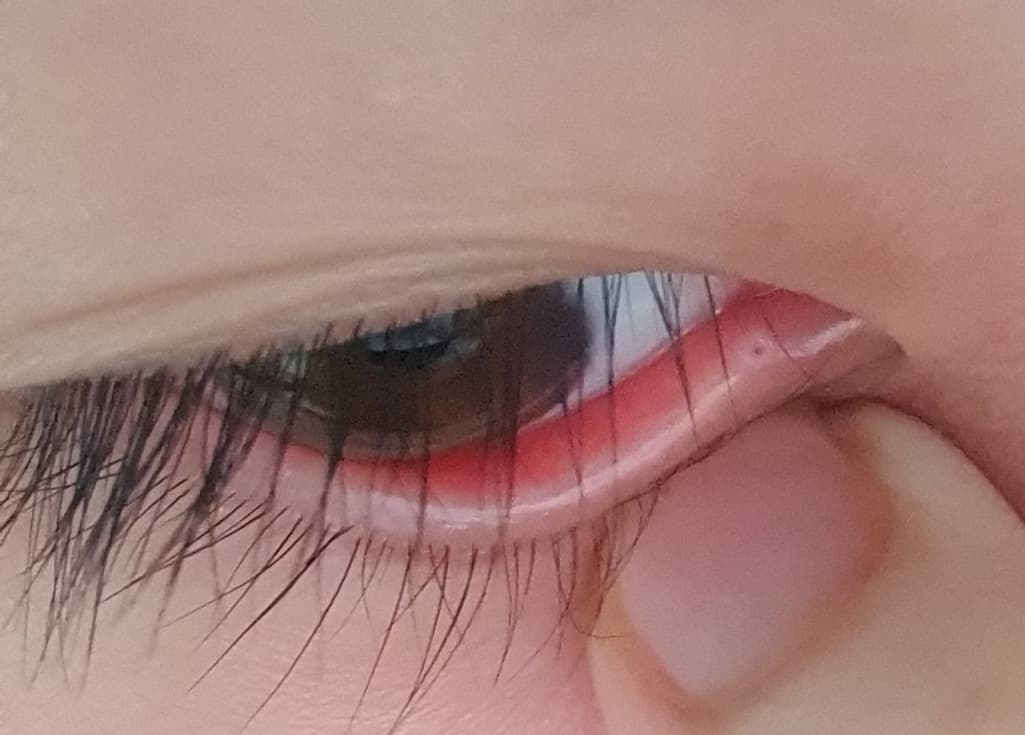 2번 째 사진