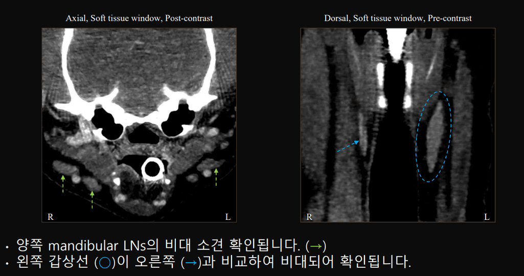 2번 째 사진