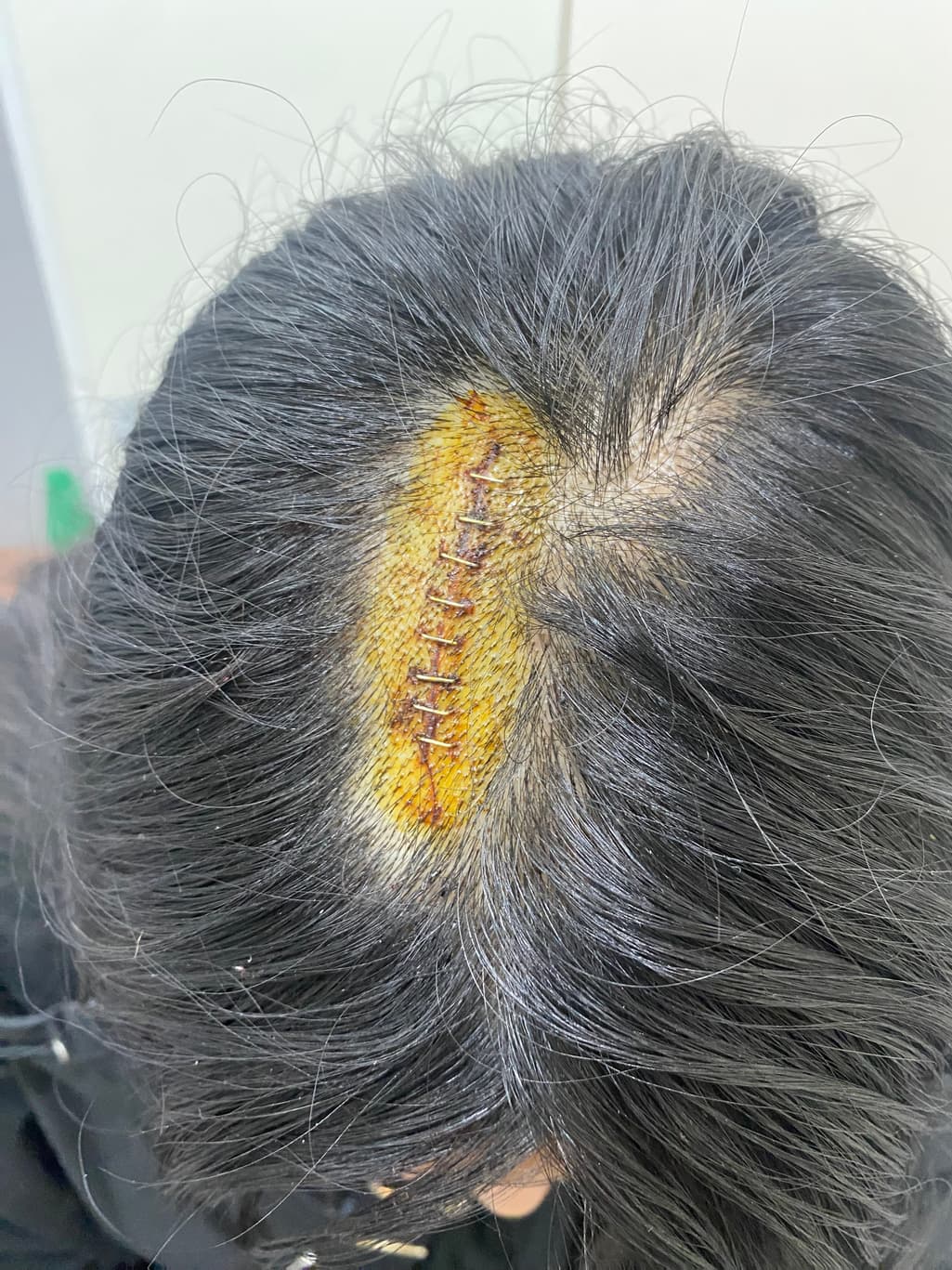1번 째 사진