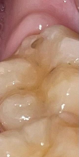 2번 째 사진