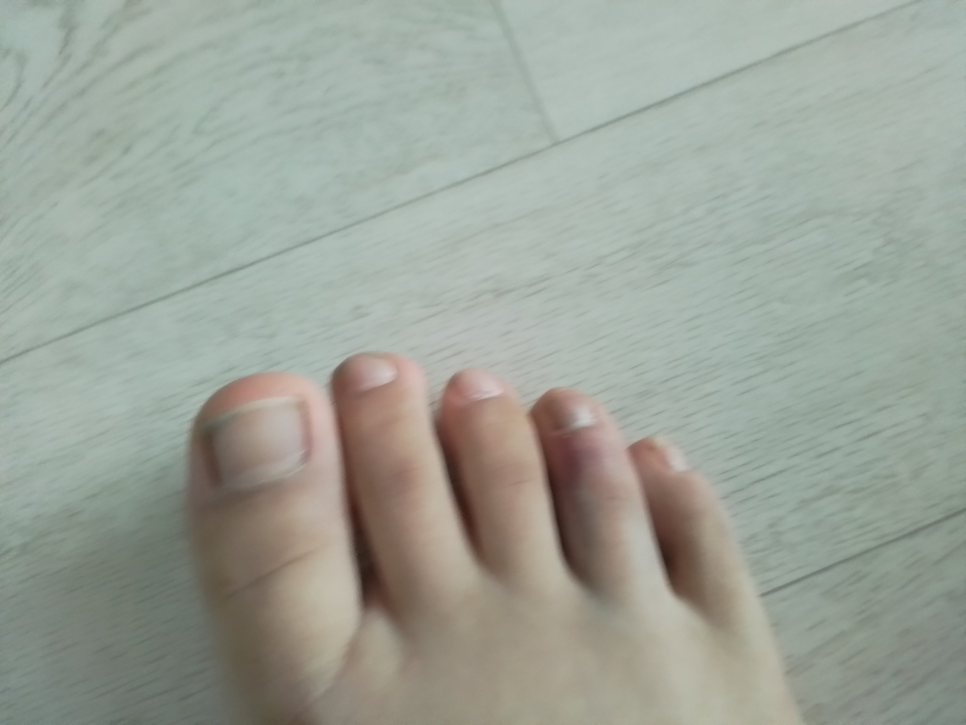 2번 째 사진