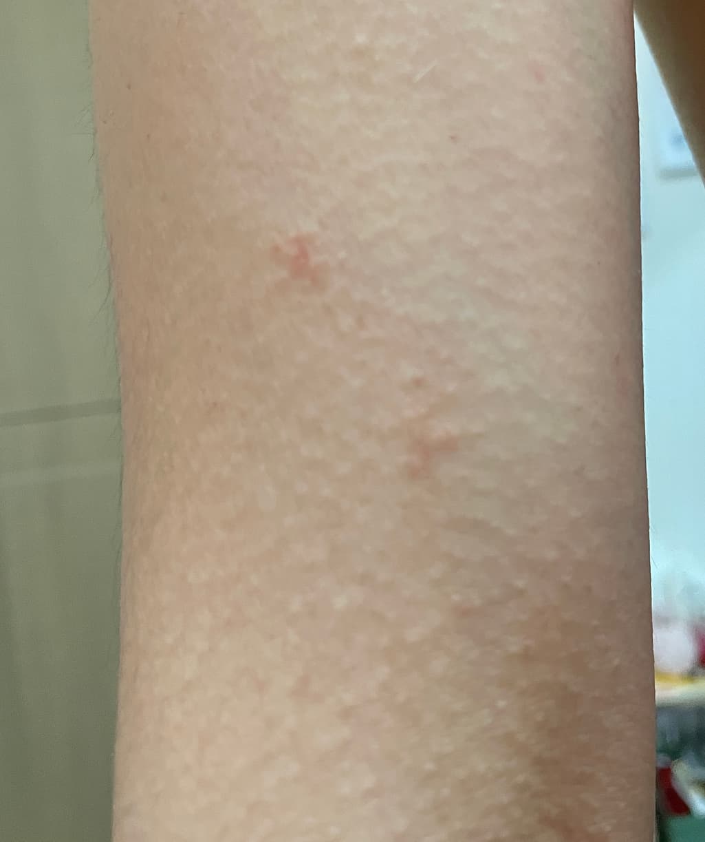 2번 째 사진