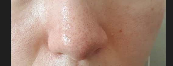 6번 째 사진