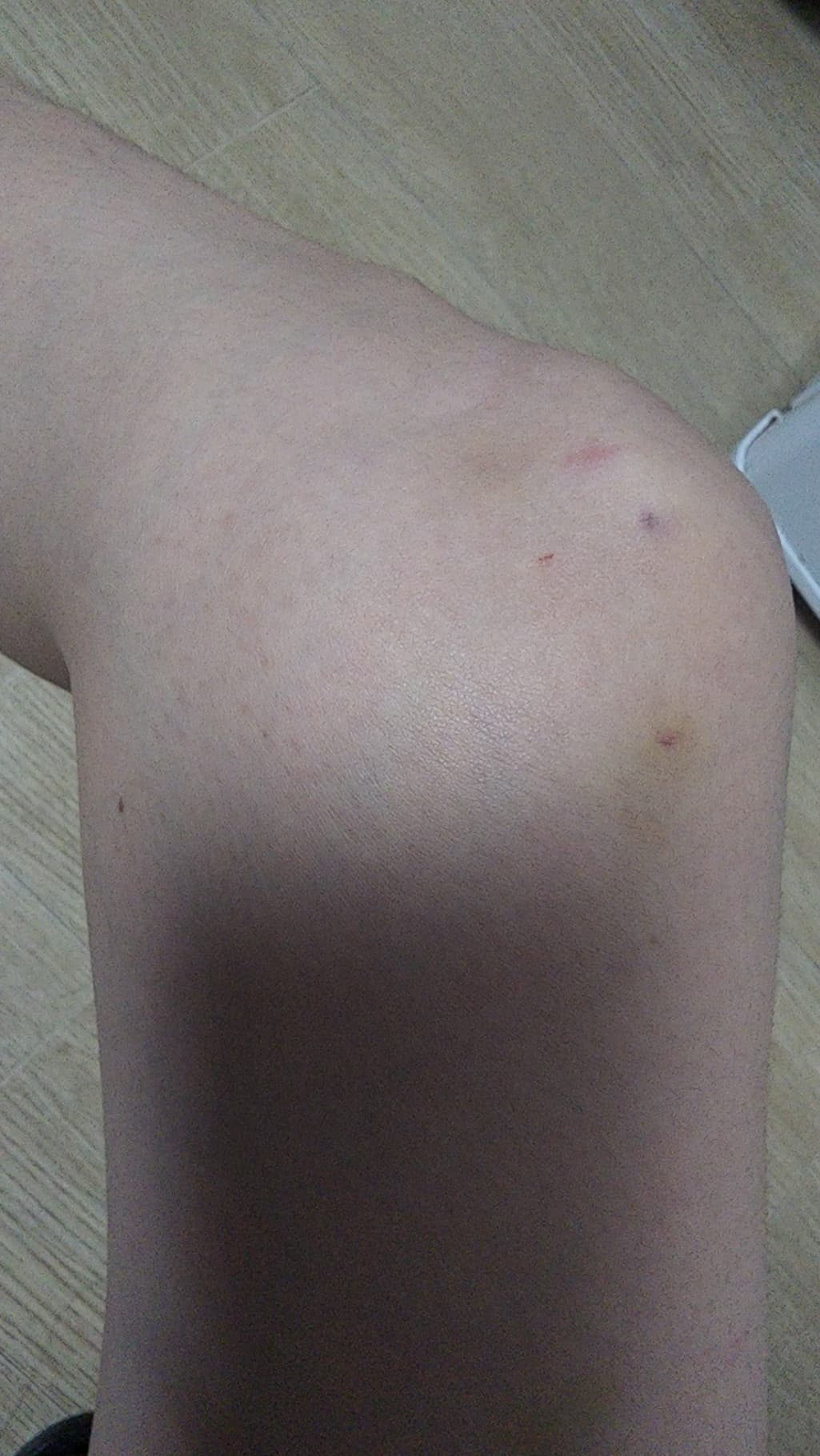 1번 째 사진
