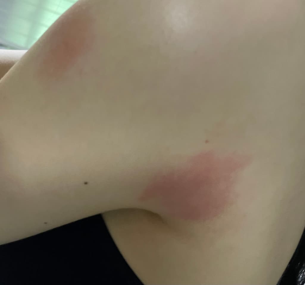 2번 째 사진