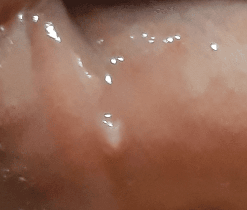 2번 째 사진