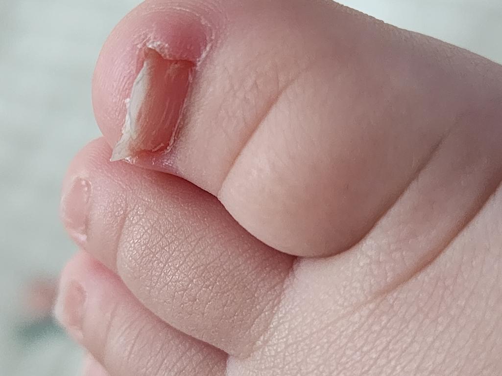 3번 째 사진