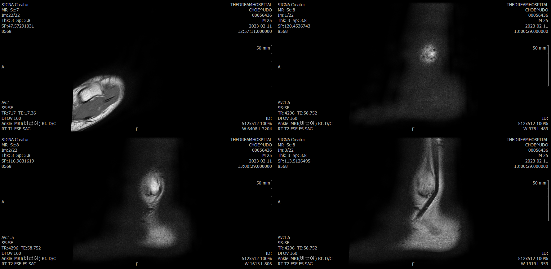 12번 째 사진