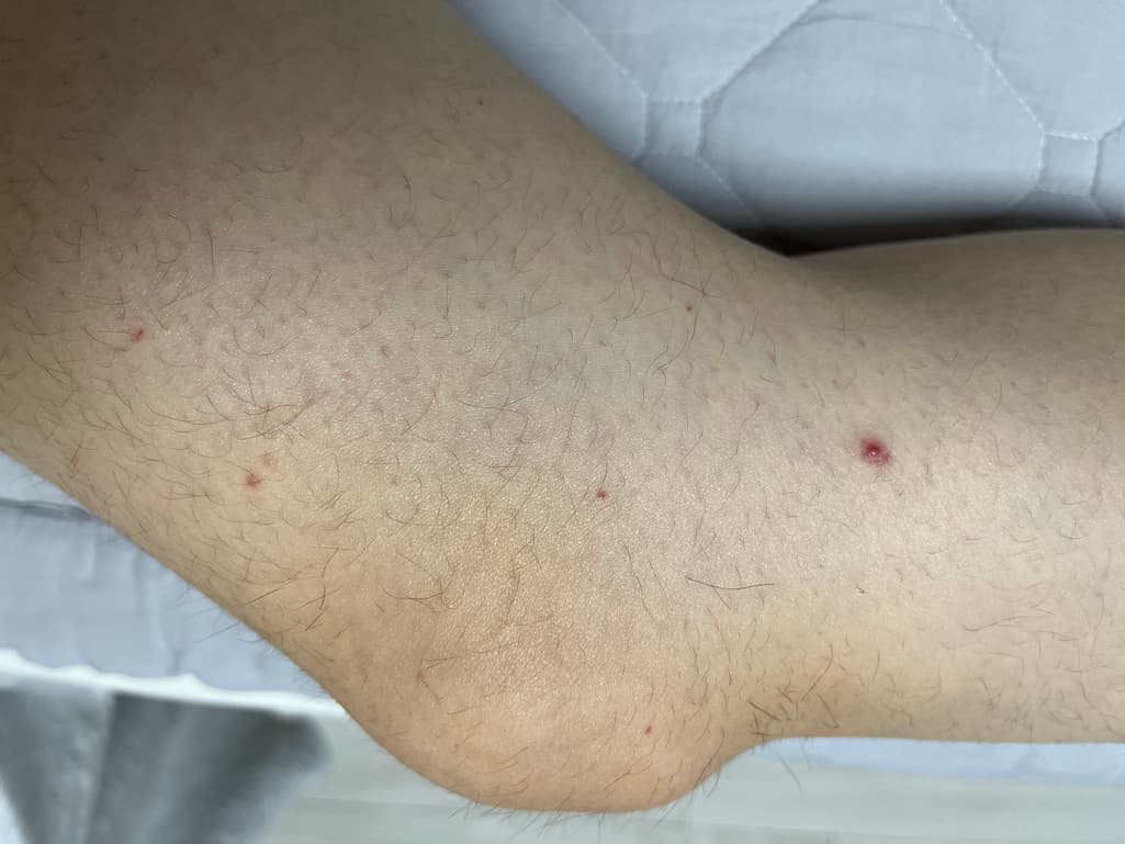 3번 째 사진