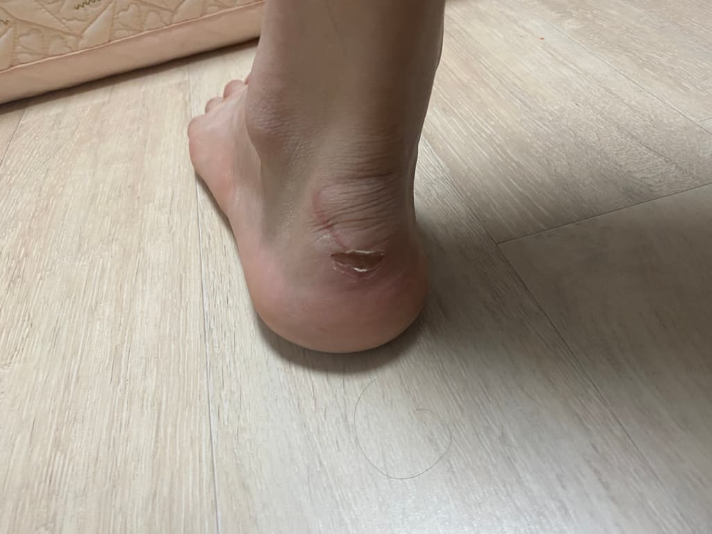 2번 째 사진